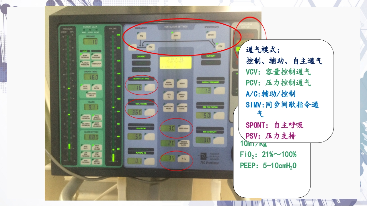 慢性阻塞性肺疾病急性加重（AECOPD）护理查房PPT62