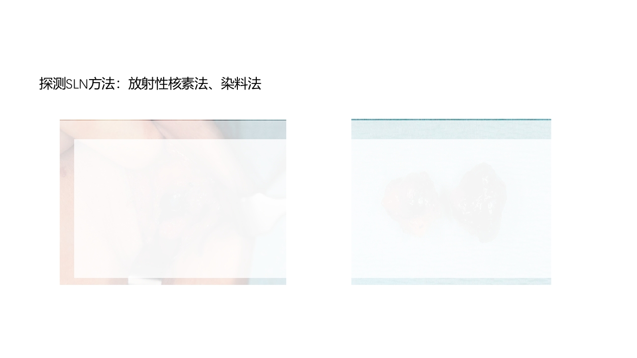 乳腺癌的护理PPT课件下载37