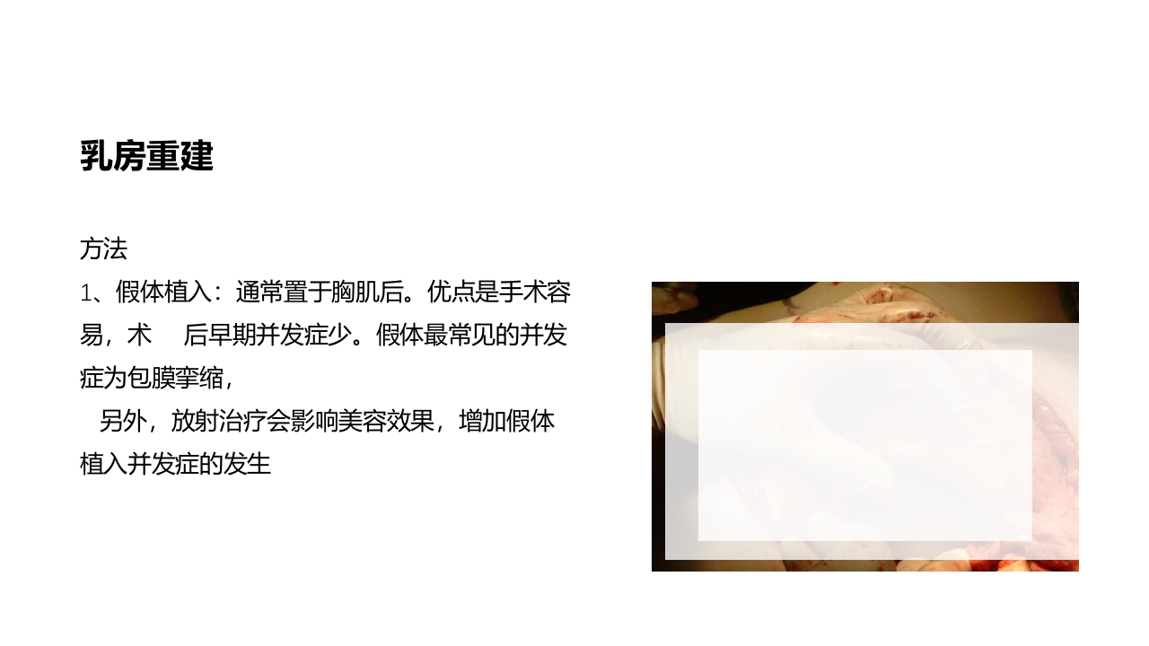 乳腺癌的护理PPT课件下载40