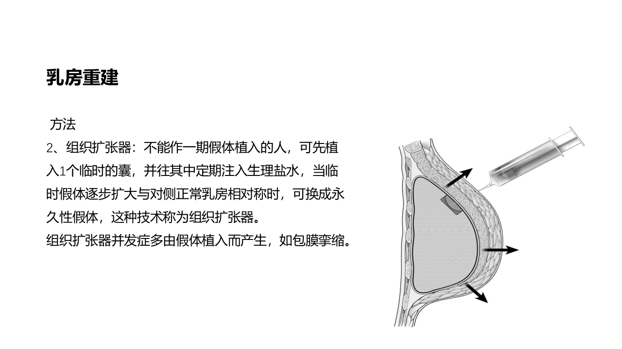 乳腺癌的护理PPT课件下载41