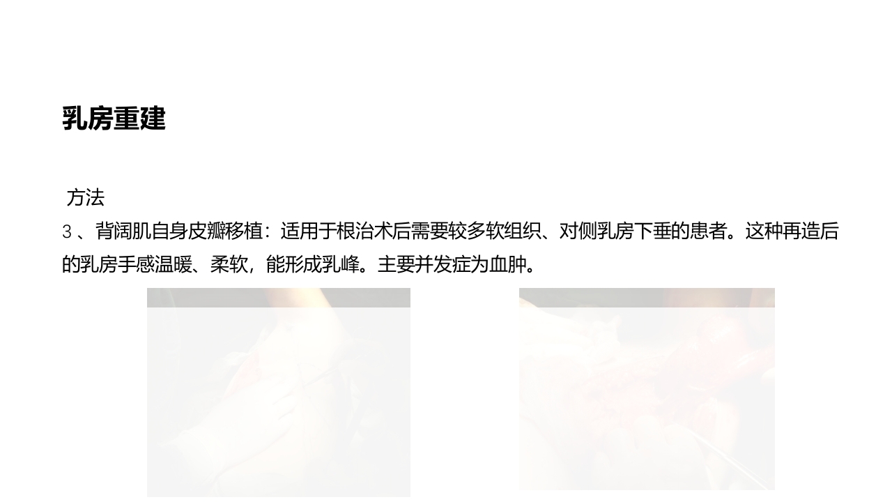 乳腺癌的护理PPT课件下载42