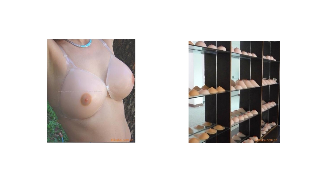 乳腺癌的护理PPT课件下载45