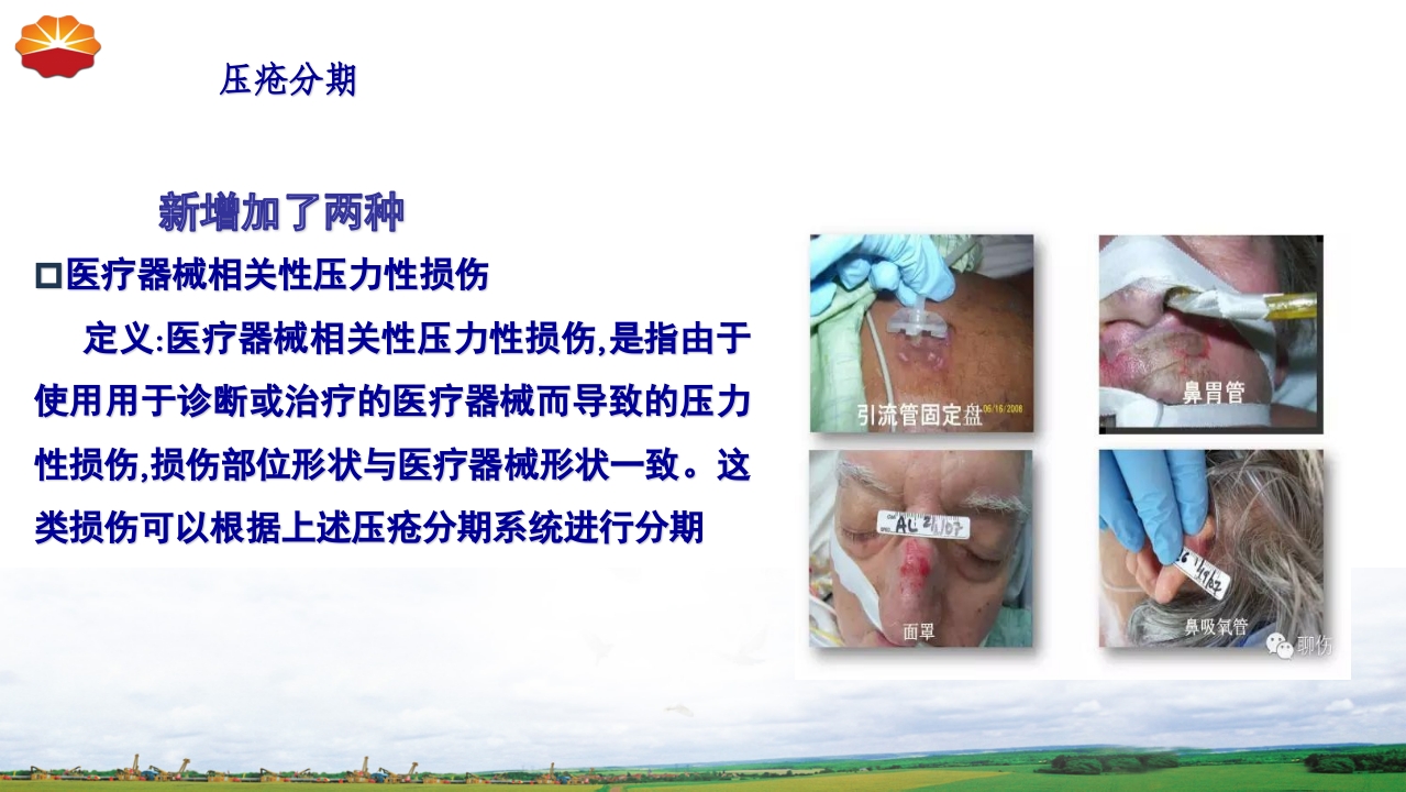 危重患者压疮的治疗及护理15