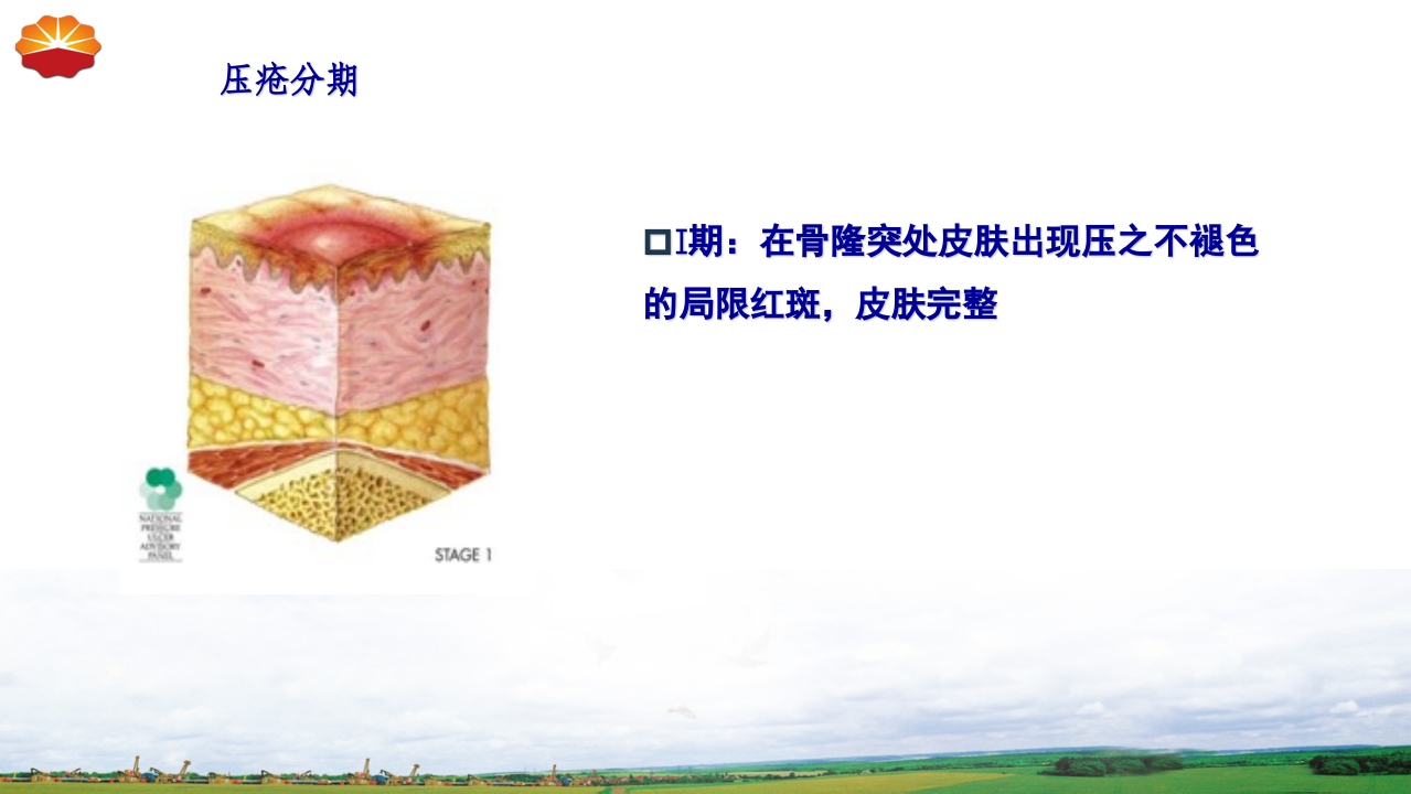 危重患者压疮的治疗及护理17