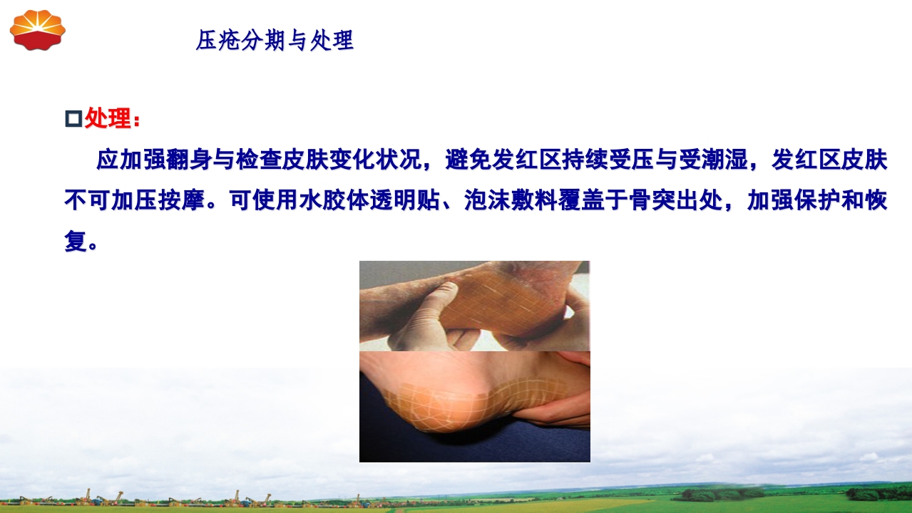 危重患者压疮的治疗及护理18