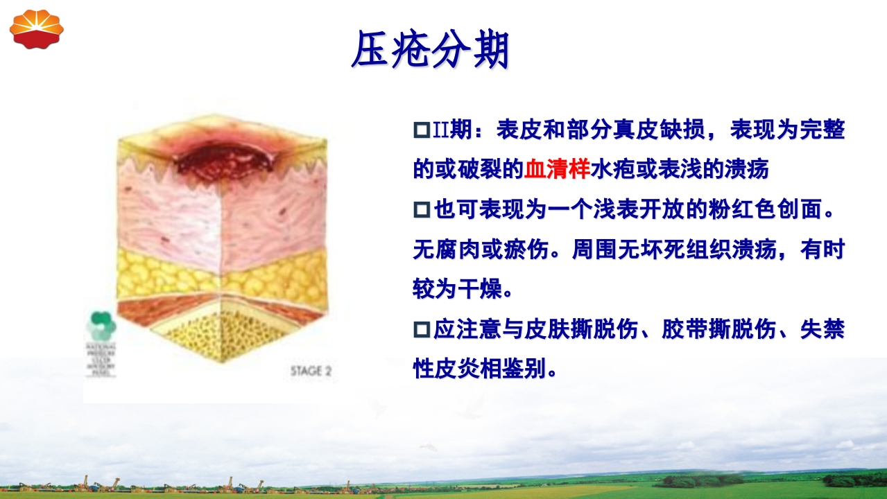 危重患者压疮的治疗及护理20