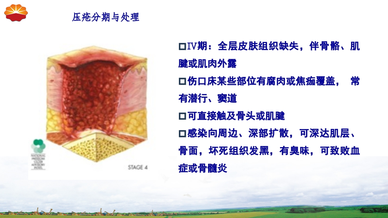 危重患者压疮的治疗及护理28