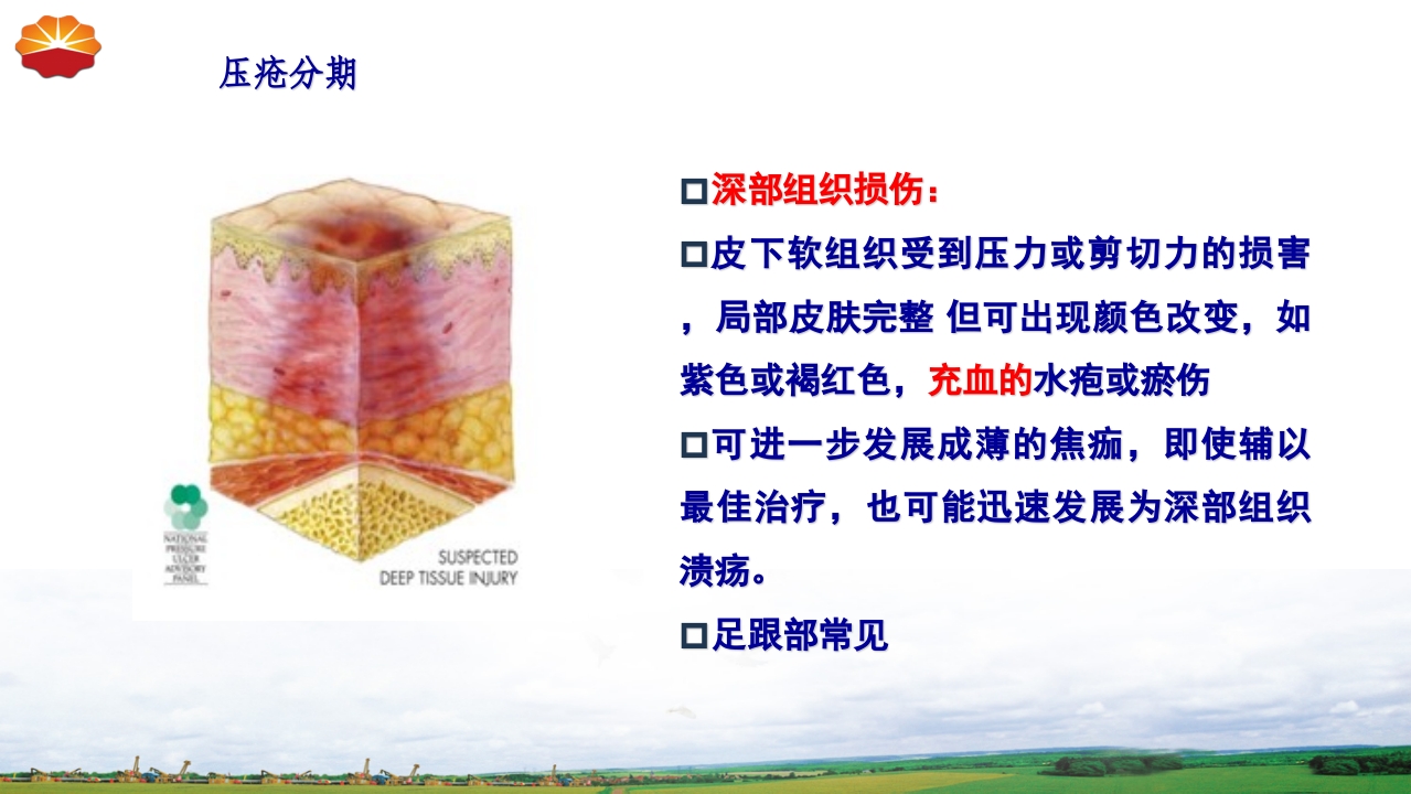 危重患者压疮的治疗及护理32