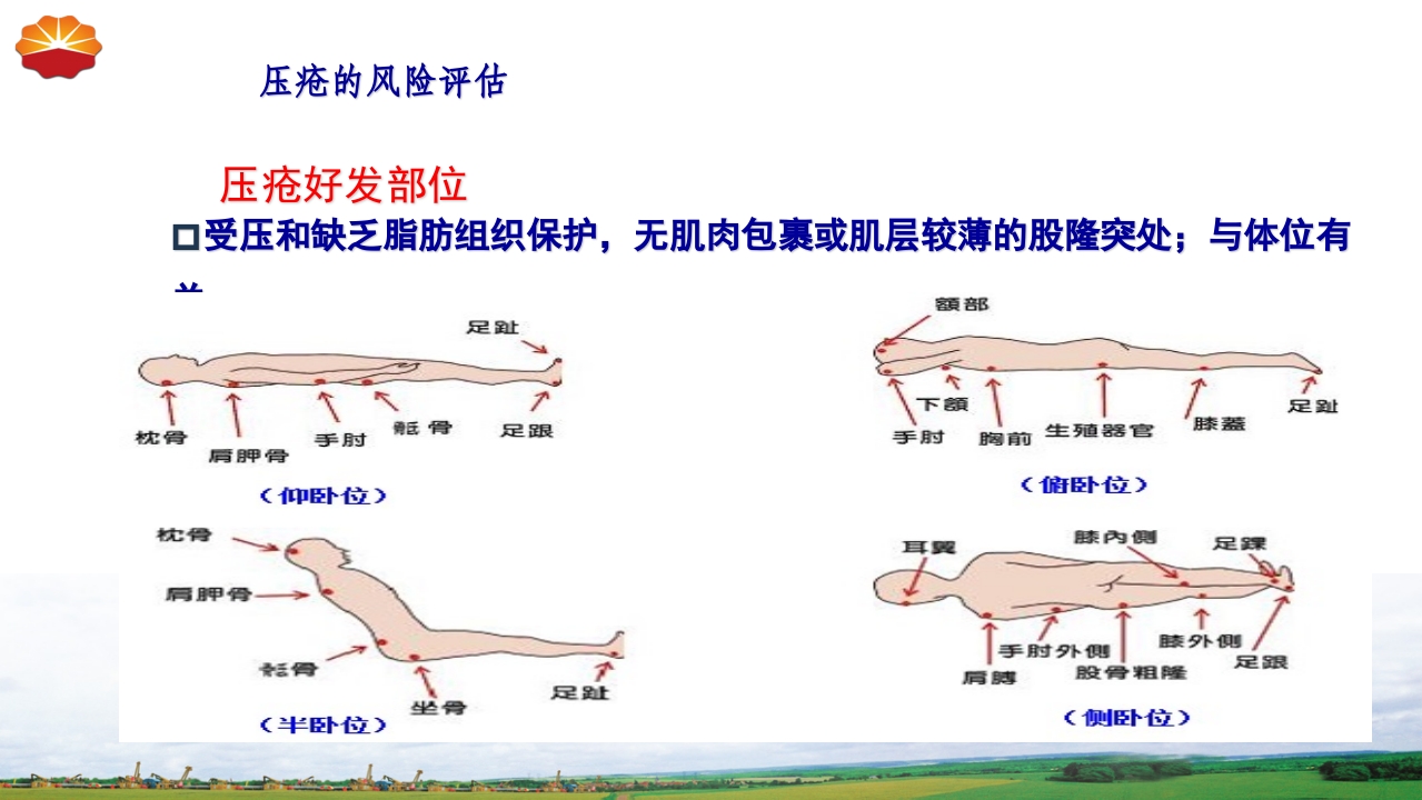危重患者压疮的治疗及护理48