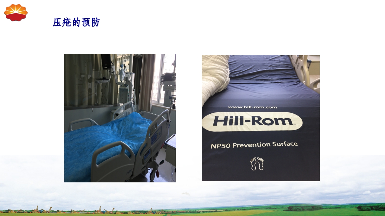 危重患者压疮的治疗及护理70