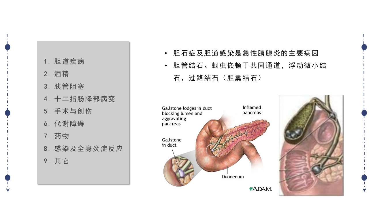 急性胰腺炎护理查房PPT课件下载6