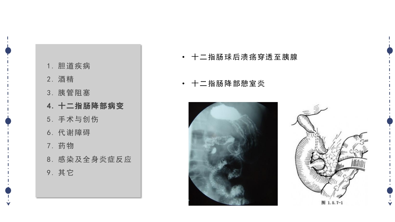 急性胰腺炎护理查房PPT课件下载9