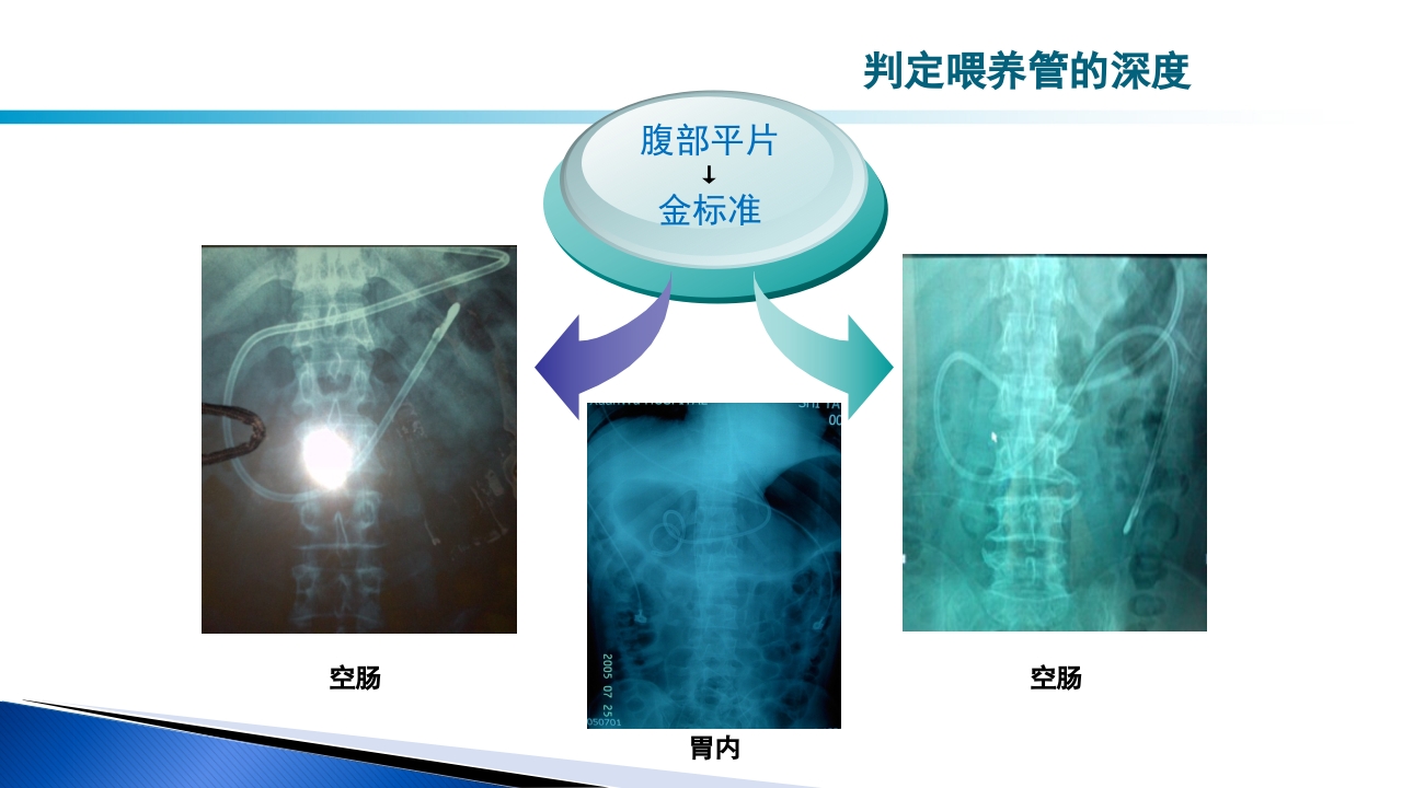 危重病人肠内营养的安全管理PPT课件27
