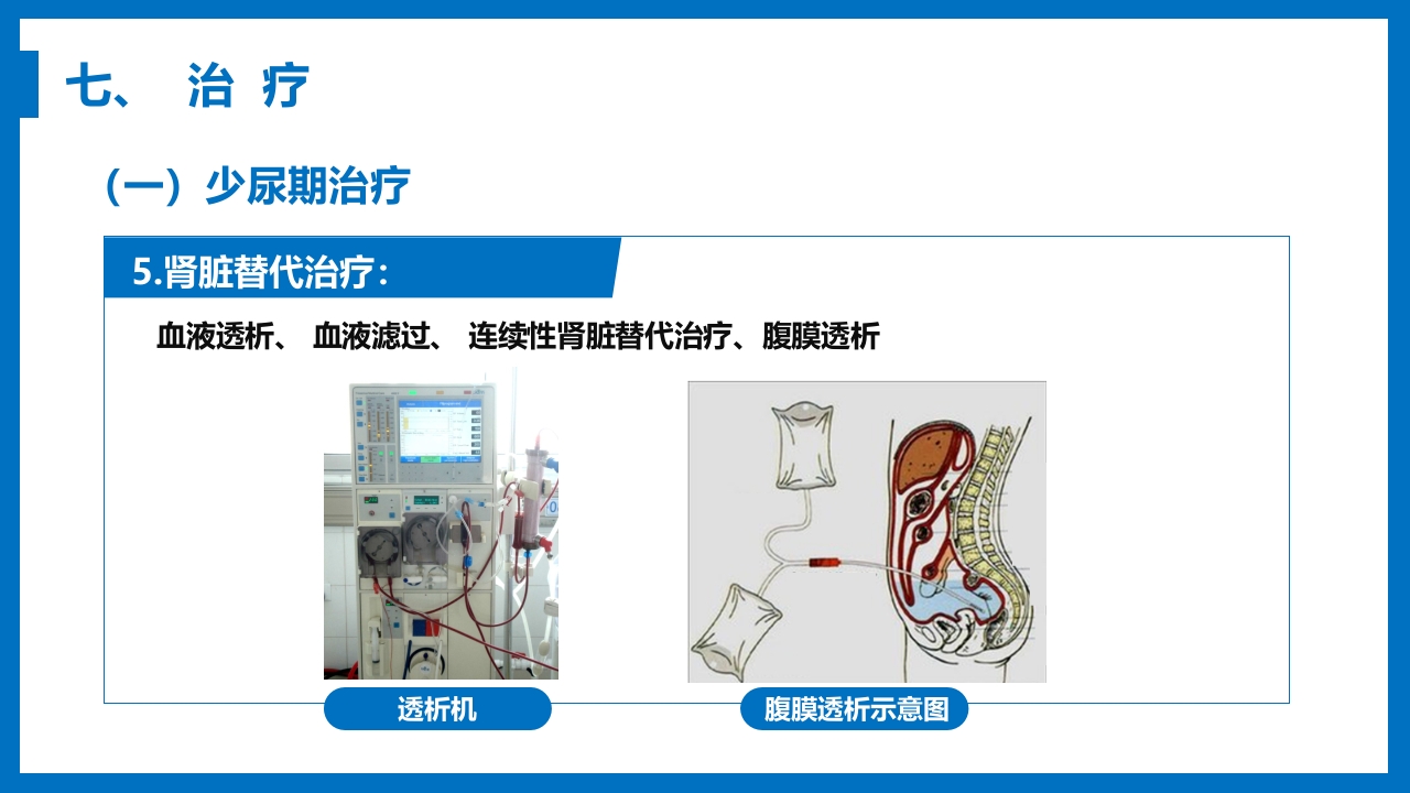 急性肾衰竭与急性肾损伤PPT课件《外科学第八章》23