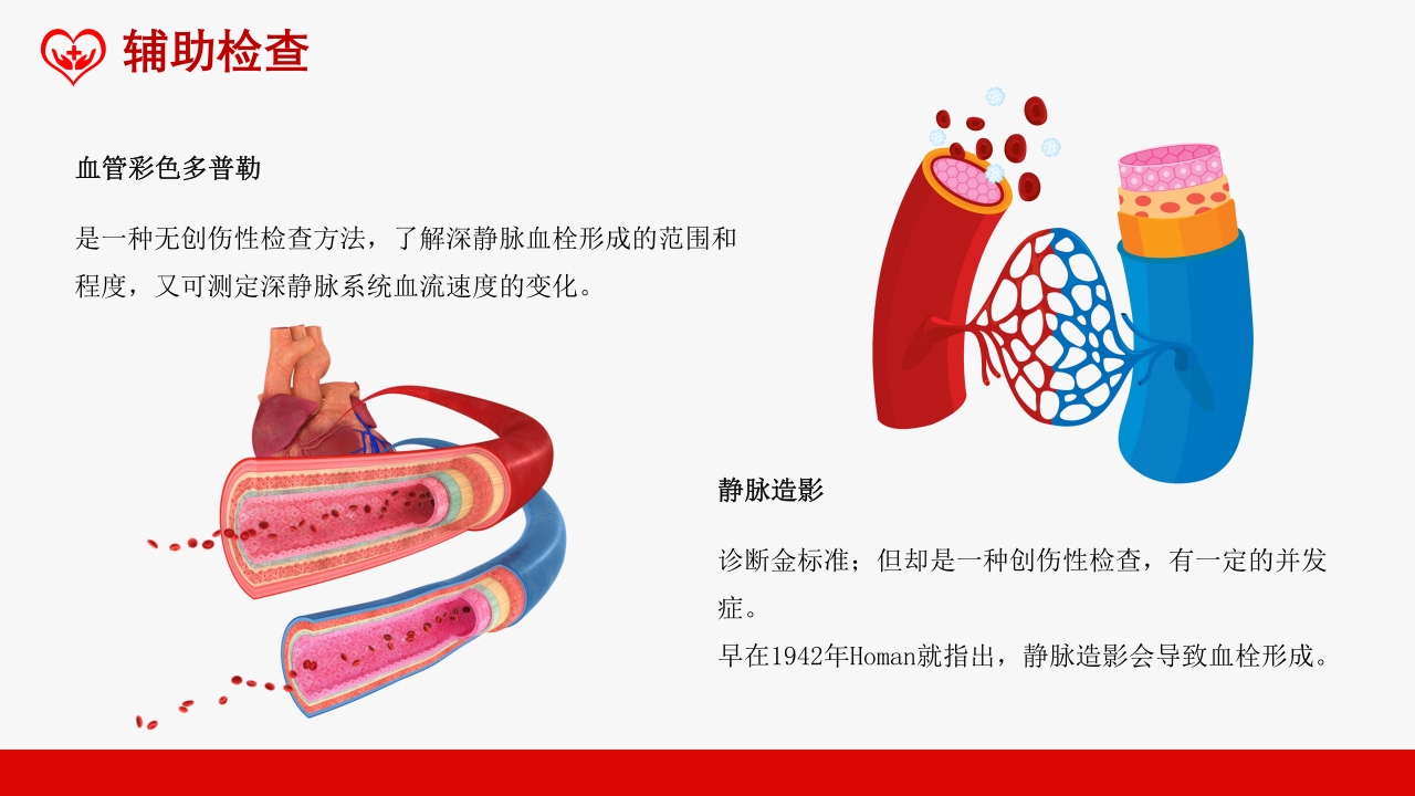 深静脉血栓健康宣教健康PPT课件10
