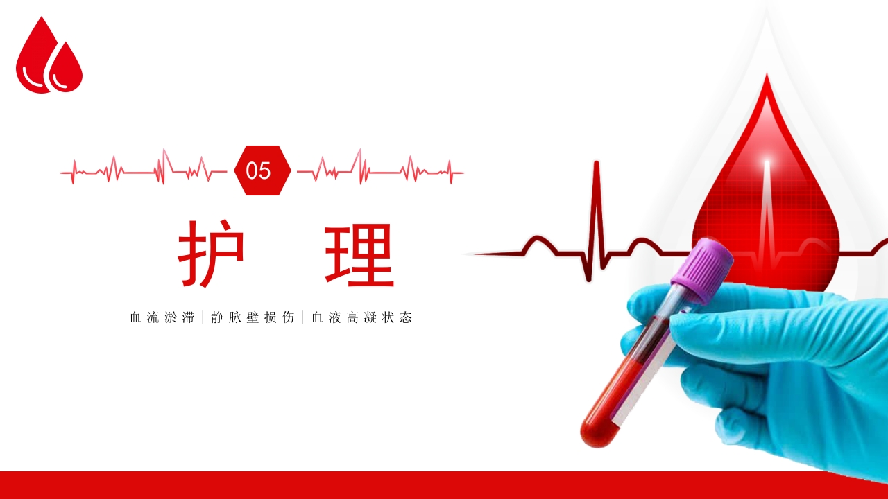 深静脉血栓健康宣教健康PPT课件14