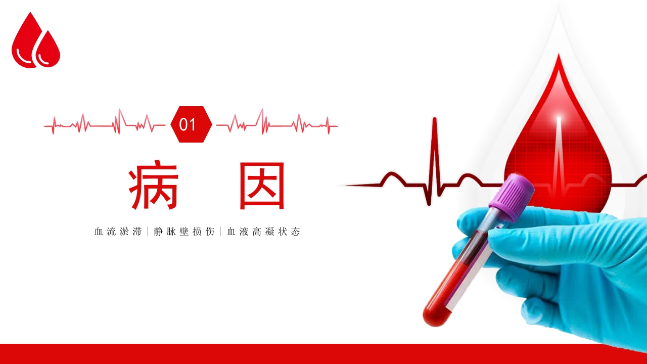 深静脉血栓健康宣教健康PPT课件4