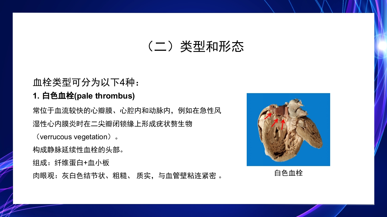 病理学第三章局部血液循环障碍PPT课件31
