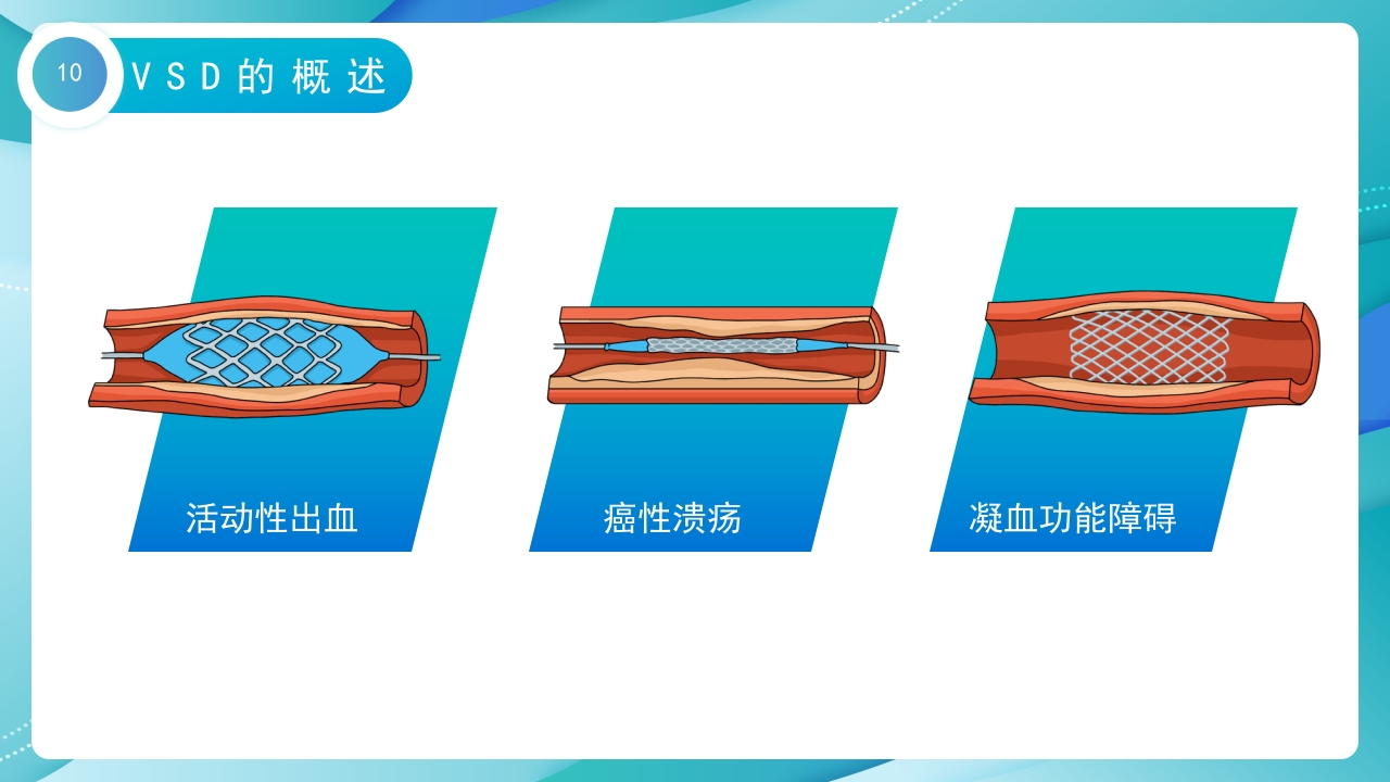 VSD负压吸引术的护理培训PPT课件10