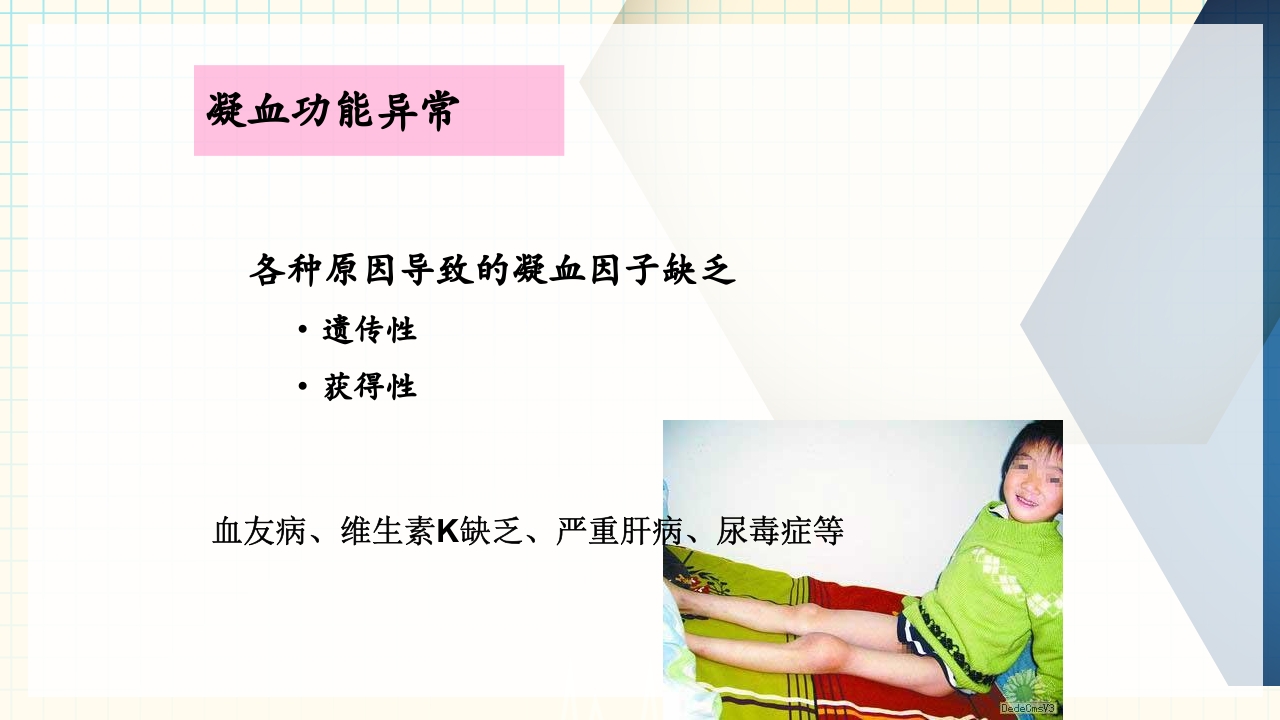 出血性疾病患者的护理PPT课件下载18