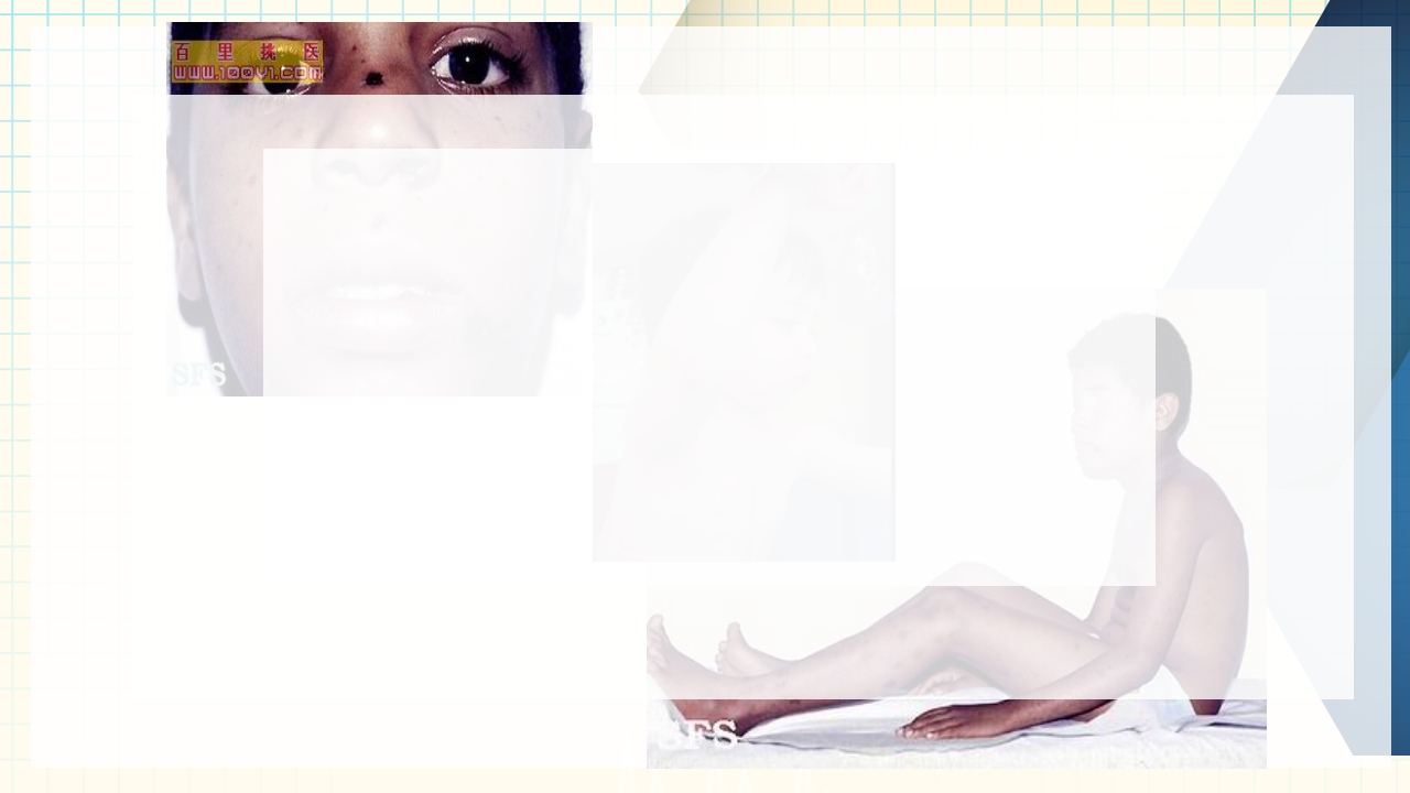 出血性疾病患者的护理PPT课件下载29