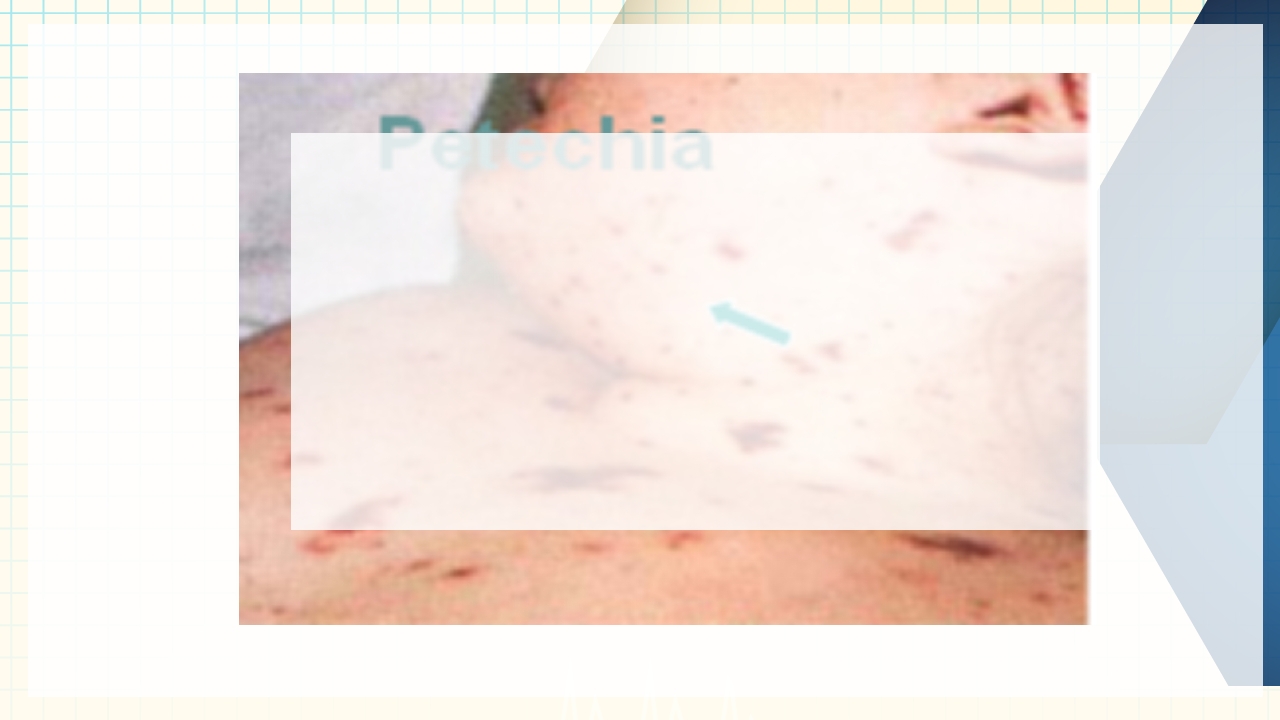 出血性疾病患者的护理PPT课件下载31