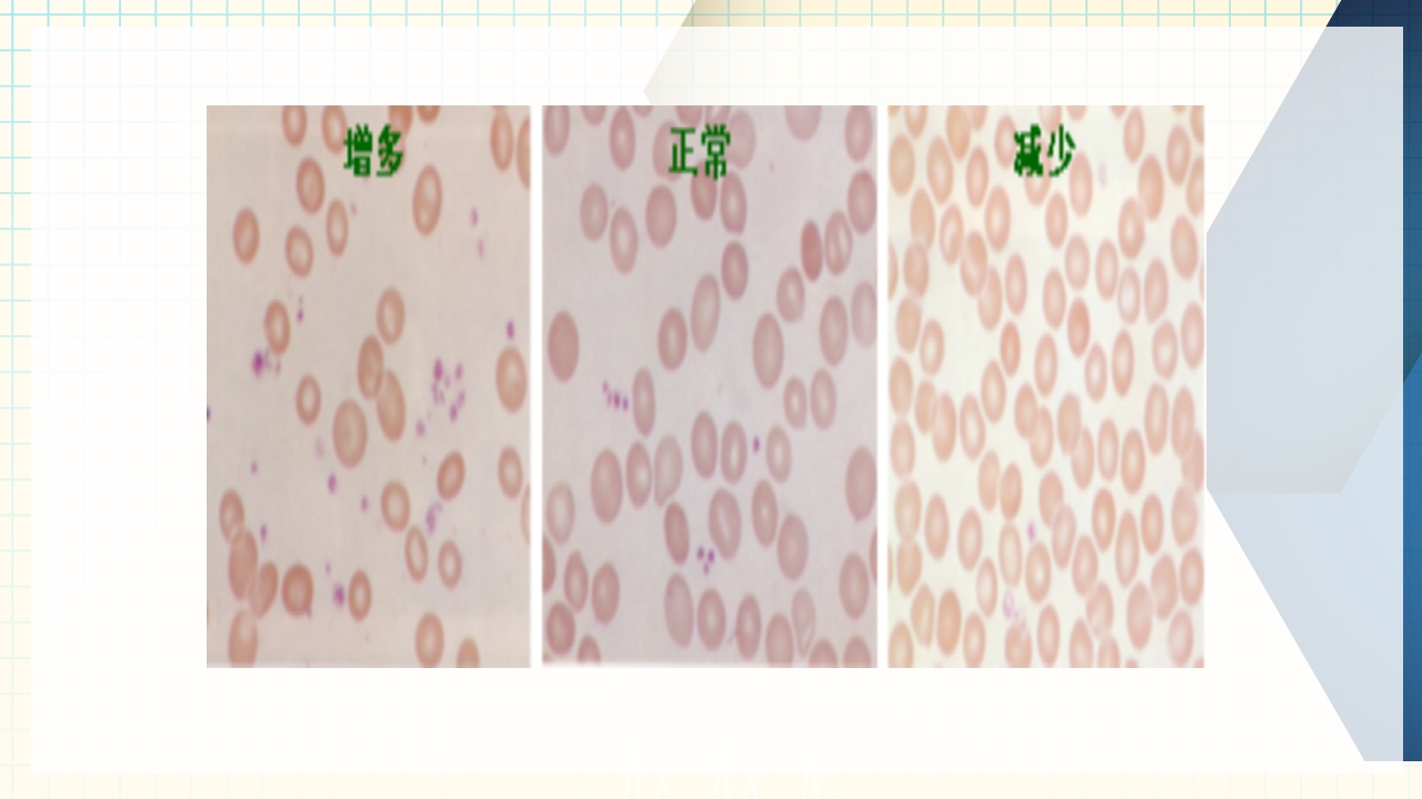 出血性疾病患者的护理PPT课件下载36