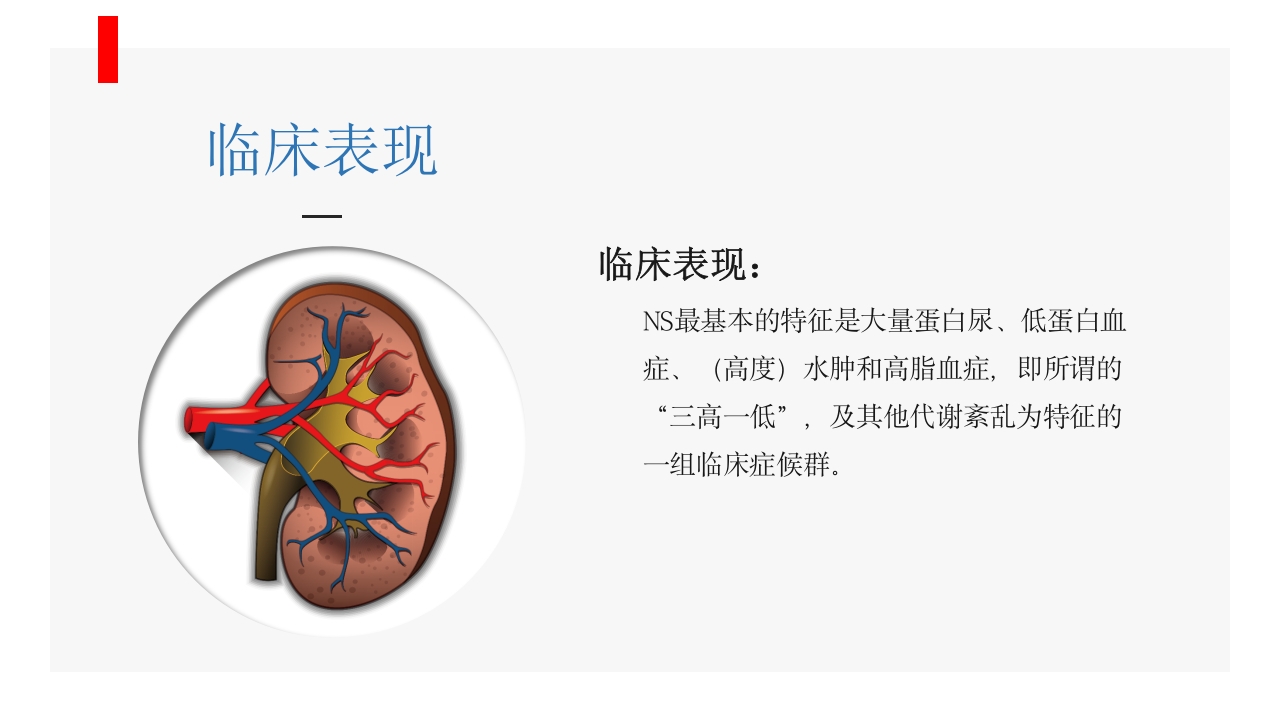 肾病综合征患者护理业务学习PPT课件7