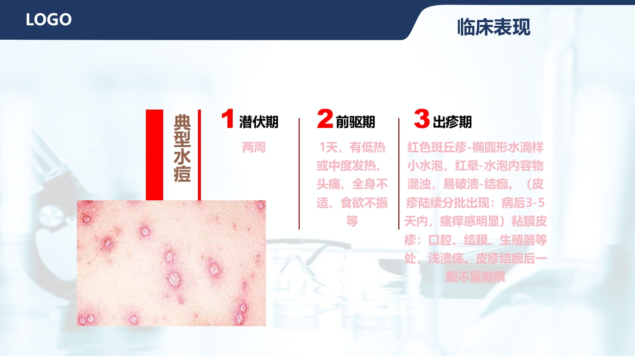 水痘护理查房PPT课件15
