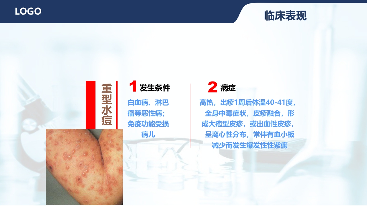 水痘护理查房PPT课件16