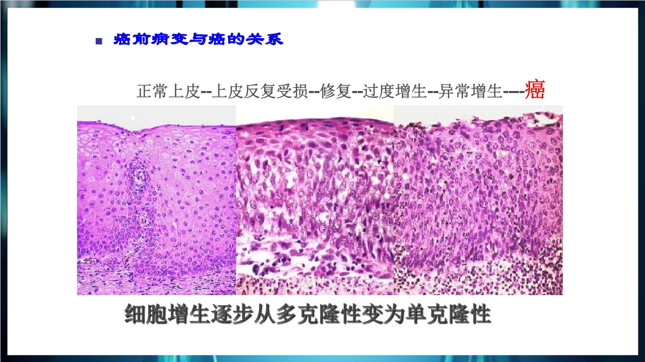 肿瘤病理学简介PPT课件下载11