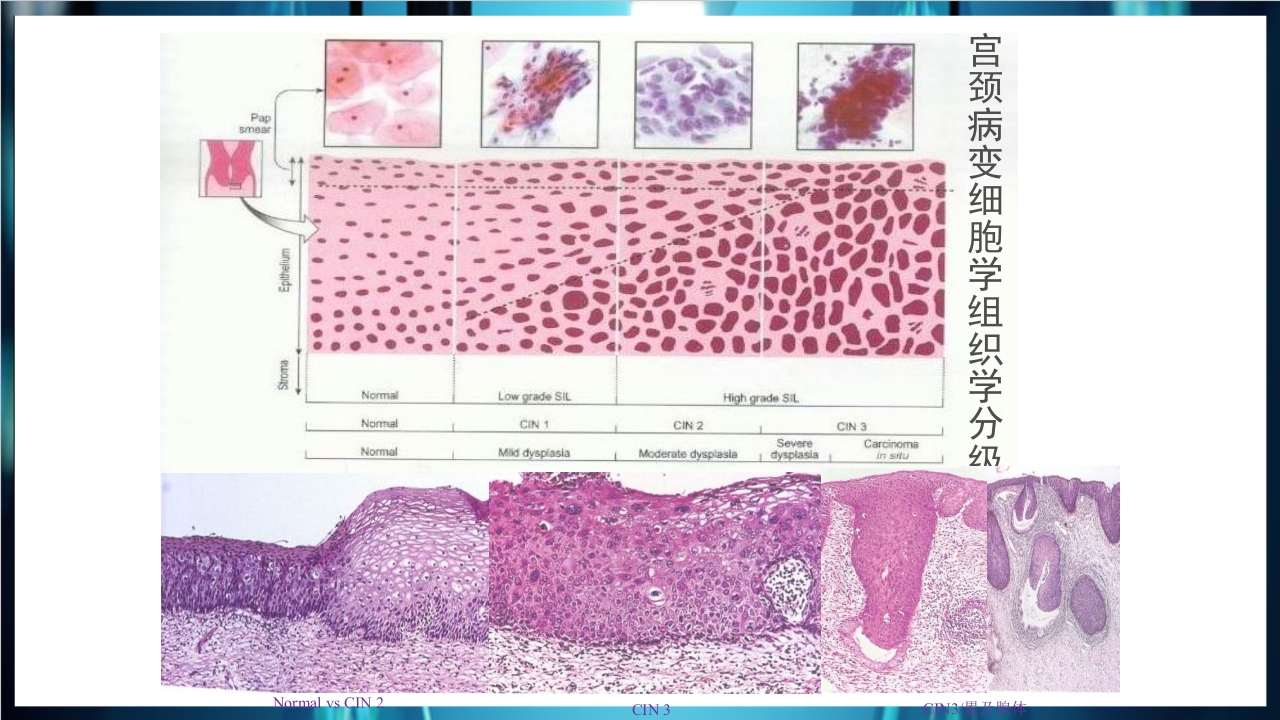 肿瘤病理学简介PPT课件下载12