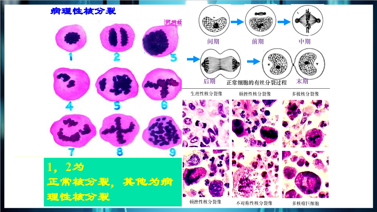 肿瘤病理学简介PPT课件下载14