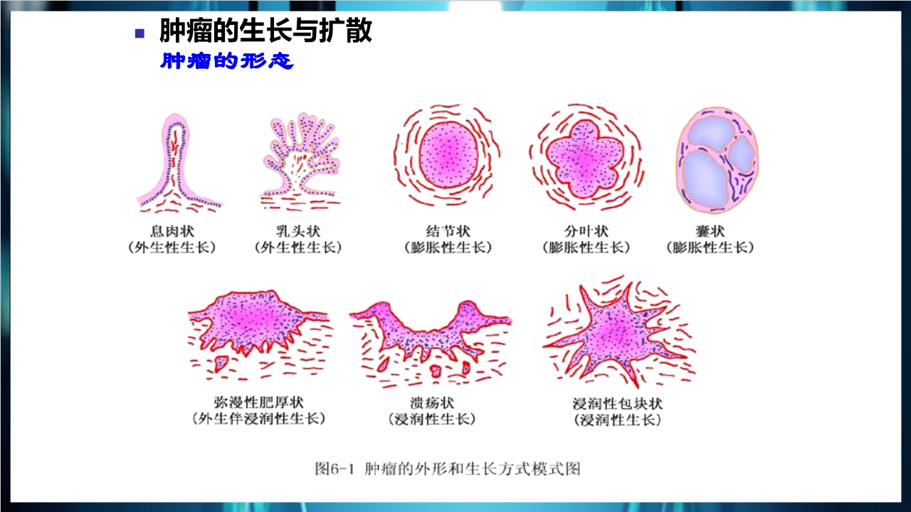 肿瘤病理学简介PPT课件下载15