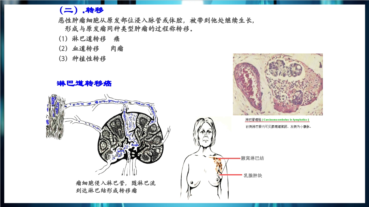 肿瘤病理学简介PPT课件下载20