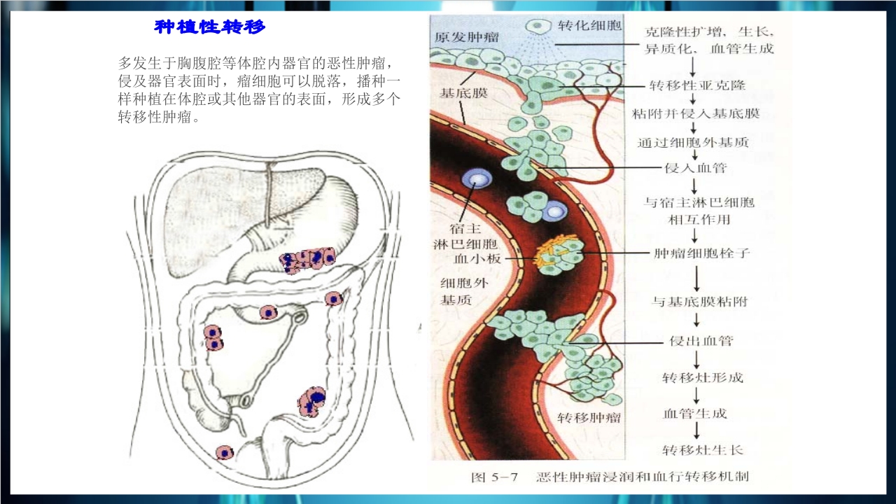 肿瘤病理学简介PPT课件下载22