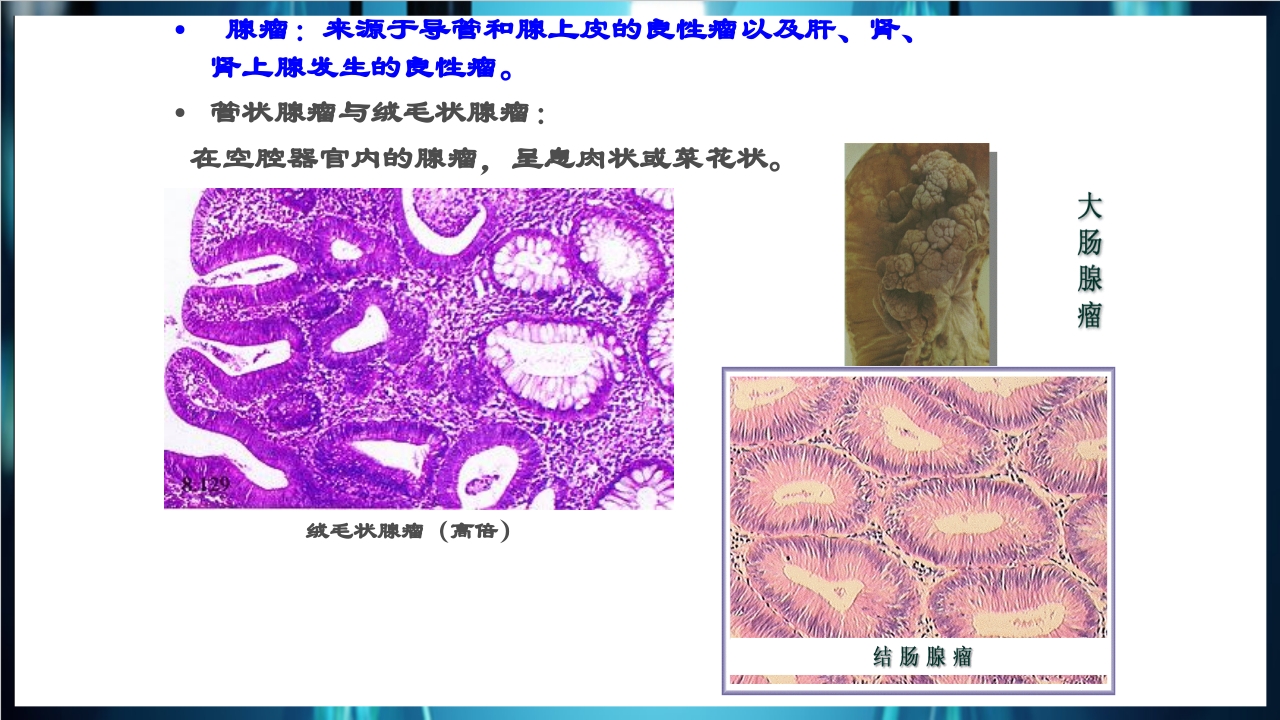 肿瘤病理学简介PPT课件下载26