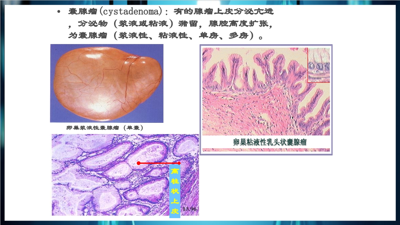 肿瘤病理学简介PPT课件下载27