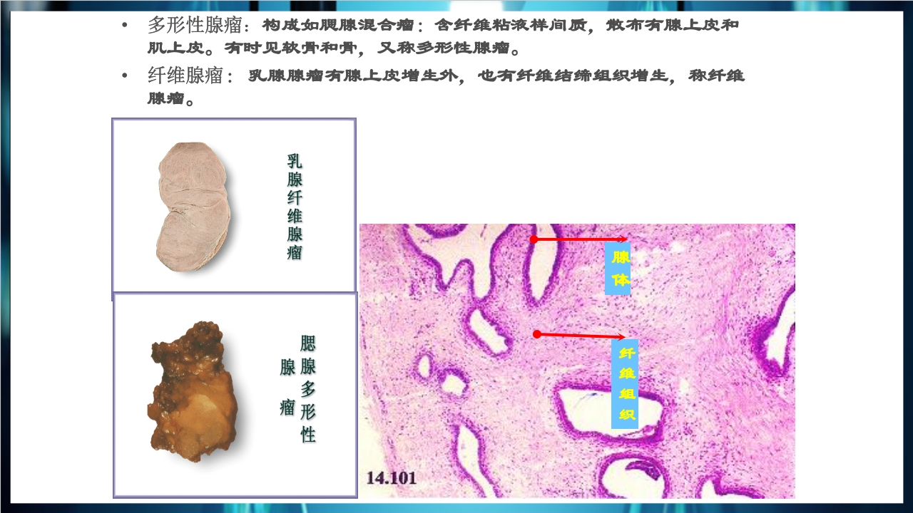 肿瘤病理学简介PPT课件下载28