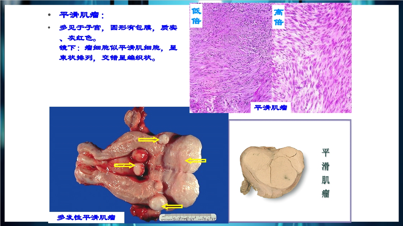 肿瘤病理学简介PPT课件下载38