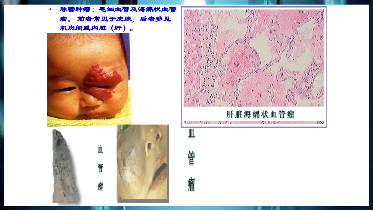 肿瘤病理学简介PPT课件下载39