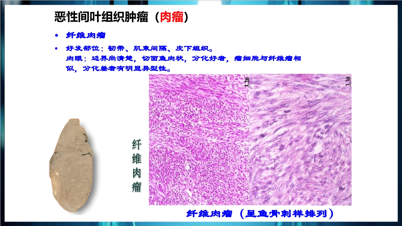 肿瘤病理学简介PPT课件下载40