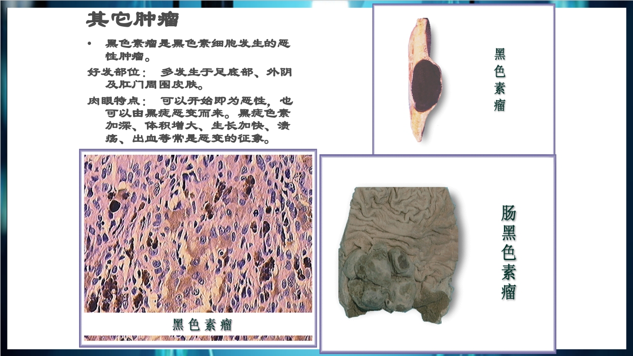 肿瘤病理学简介PPT课件下载50