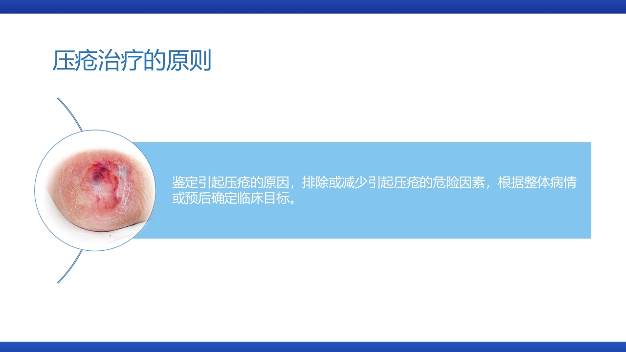 医疗风压疮的预防和护理PPT课件下载9