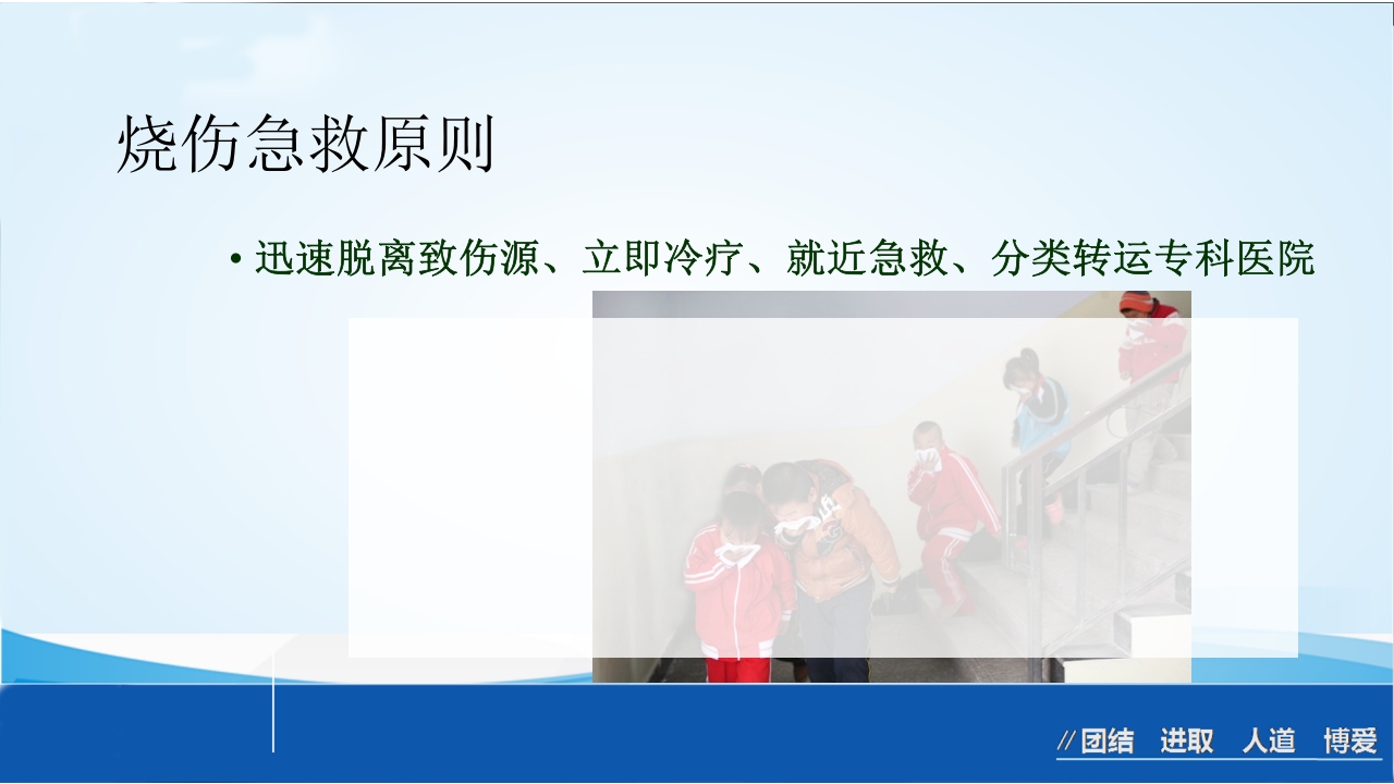 烧伤急救处理ppt课件36