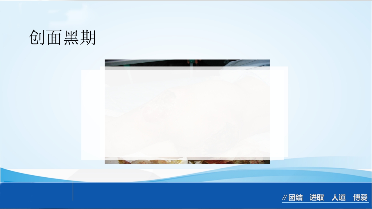 烧伤急救处理ppt课件49