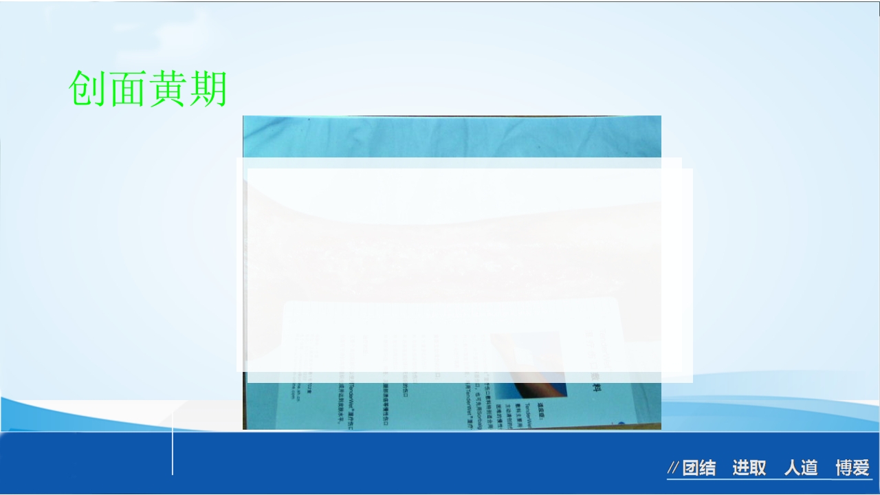 烧伤急救处理ppt课件51
