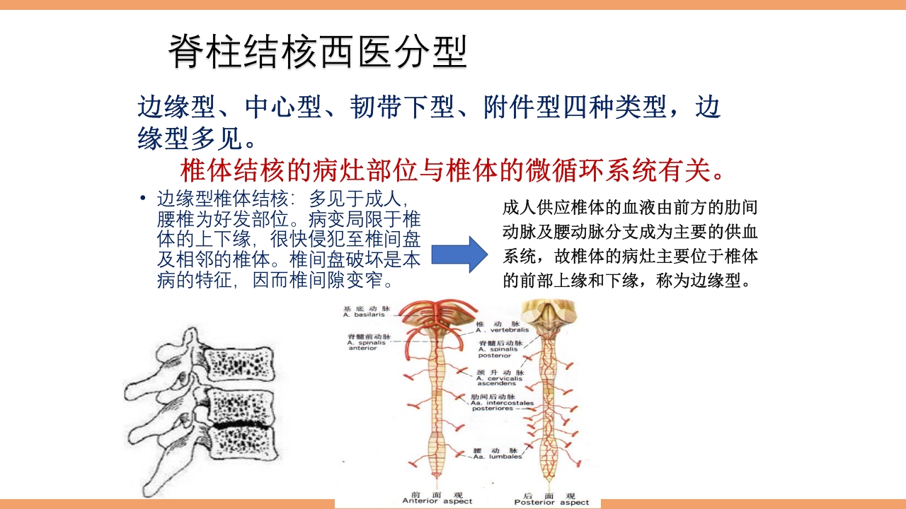 脊柱结核的护理PPT课件下载12