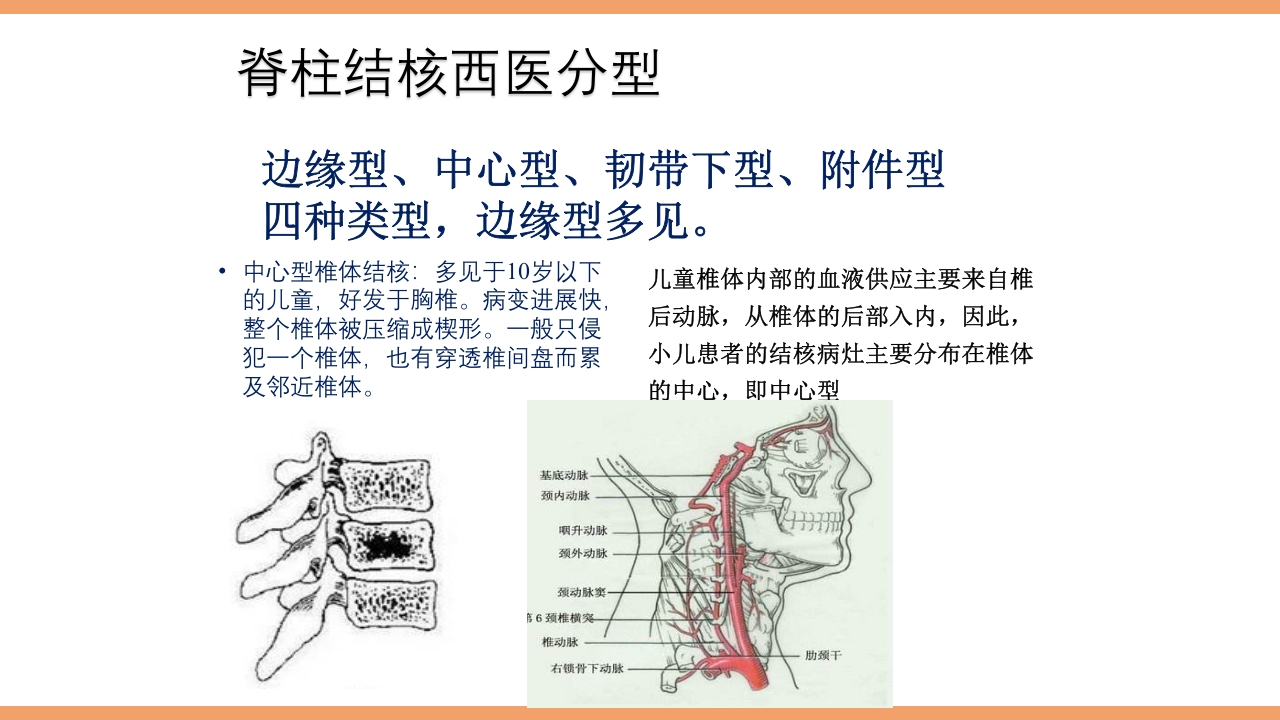 脊柱结核的护理PPT课件下载13