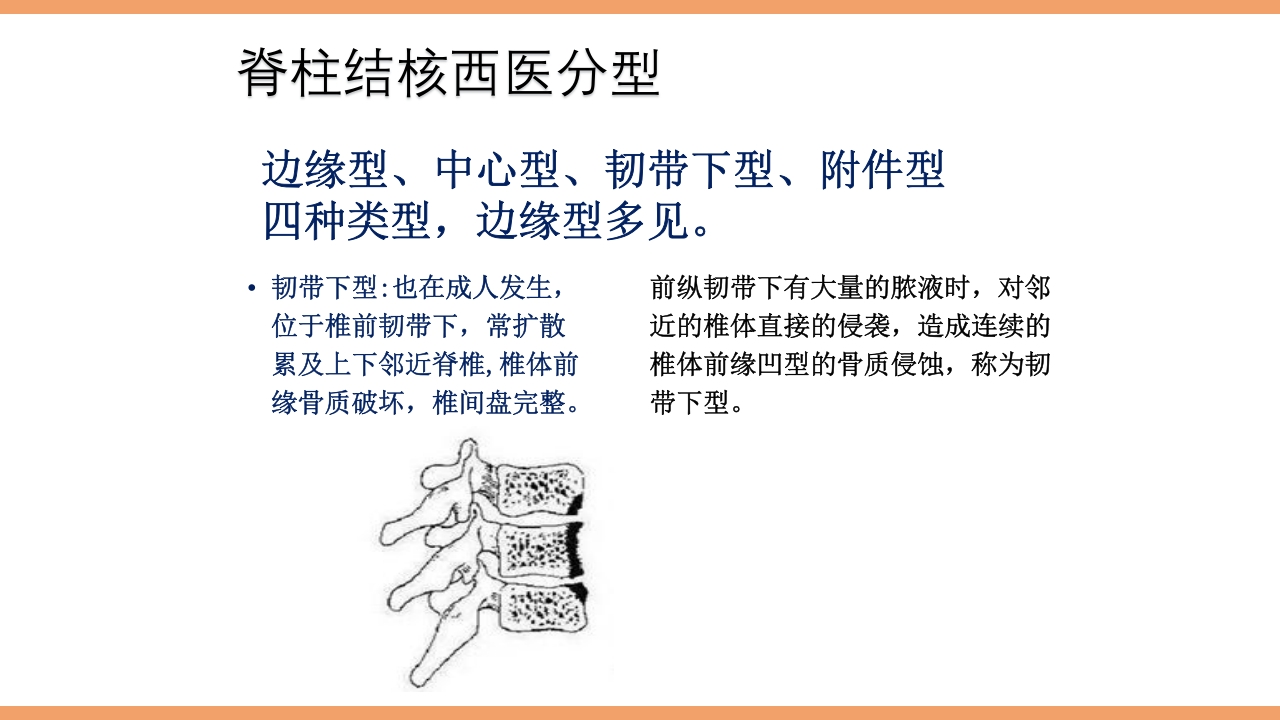 脊柱结核的护理PPT课件下载14